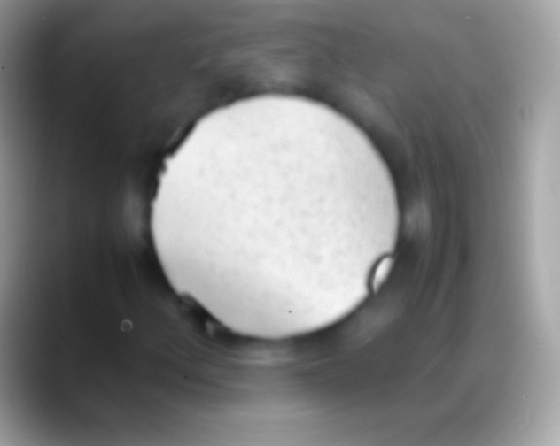 X0000088151156200706041350