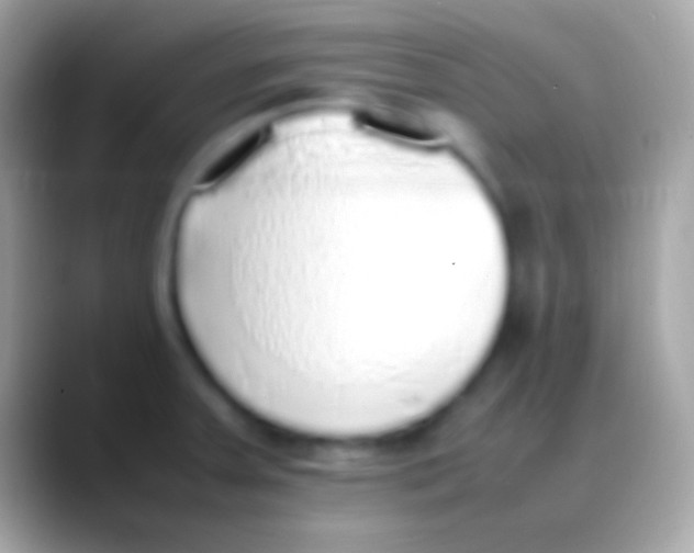 X0000088151379200706041347