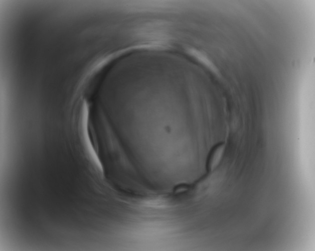 X0000088151455200706041346