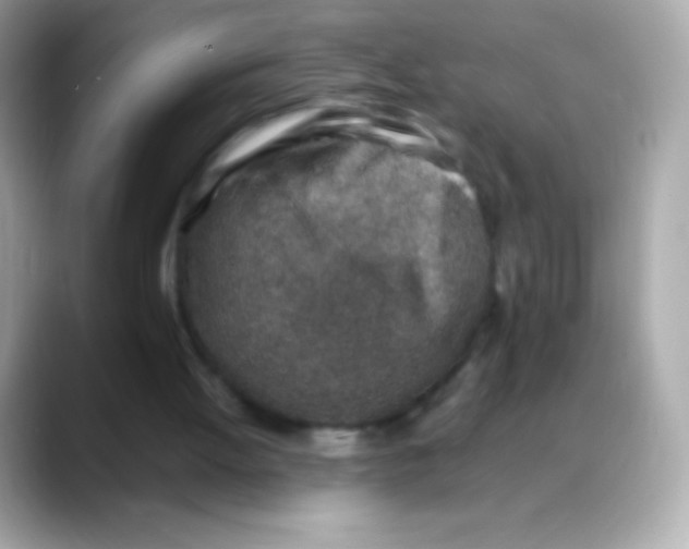 X0000088150052200706042037