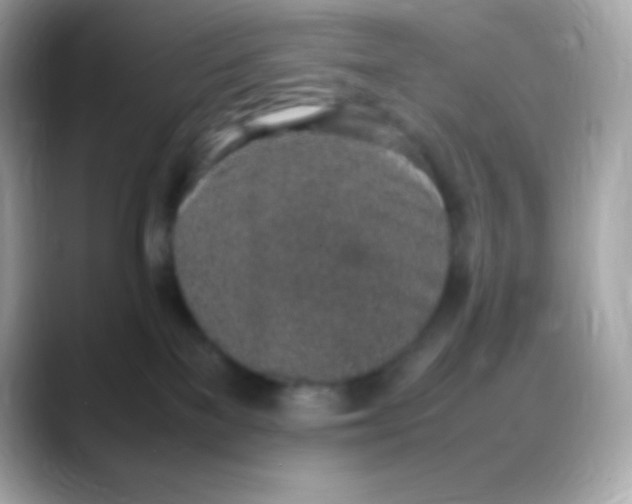 X0000088150137200706042036