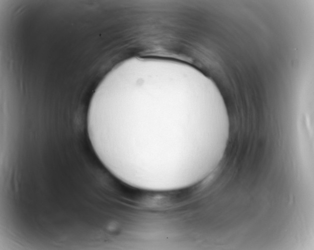 X0000088150174200706042036