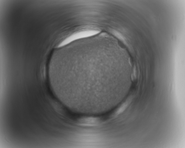 X0000088150205200706042036