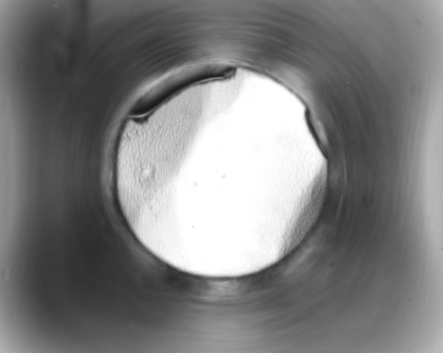 X0000088151144200706042024