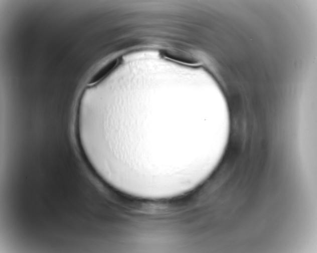 X0000088151379200706042020