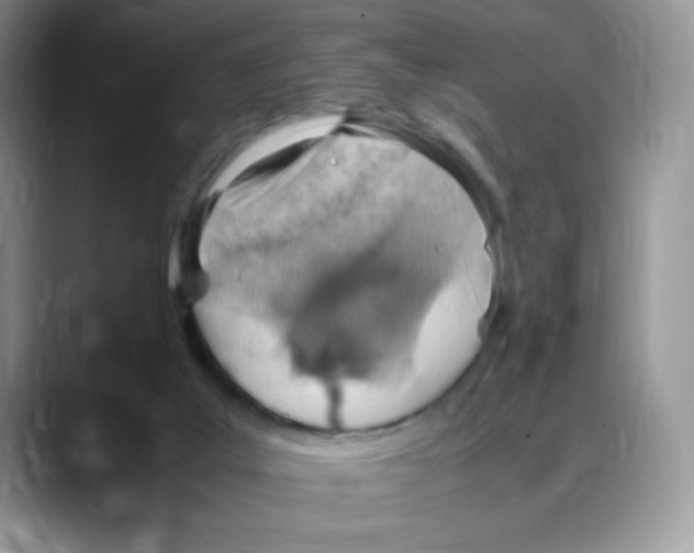 X0000088150019200706111451