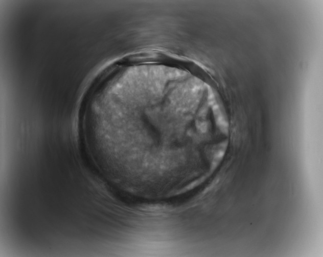 X0000088150200200706111449