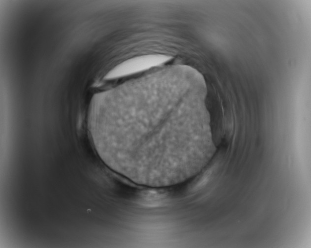 X0000088150239200706111449