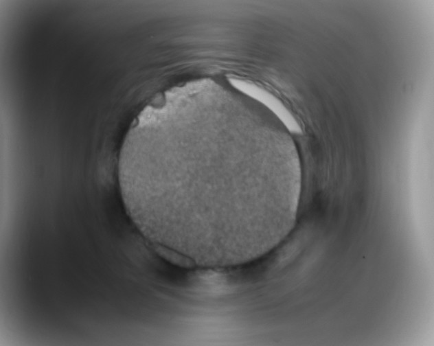 X0000088150325200706111448