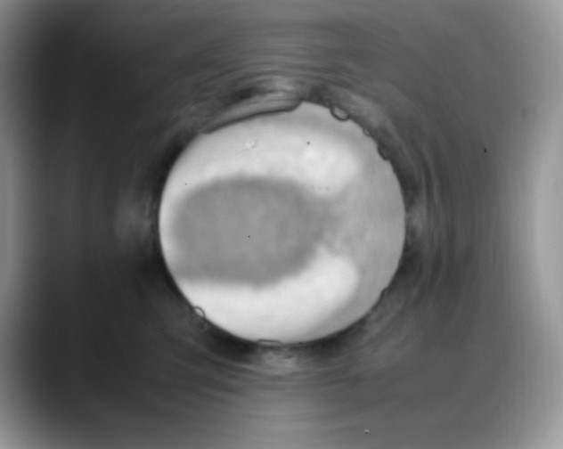 X0000088150423200706111447