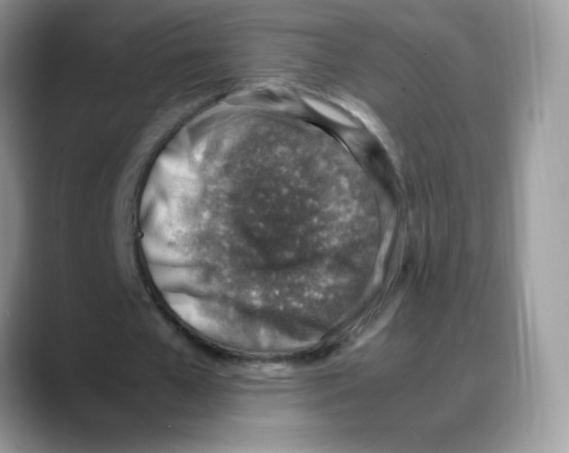 X0000088150577200706111445