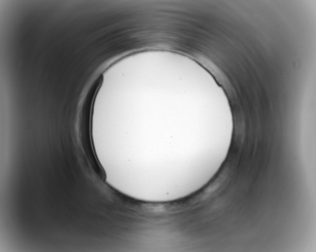 X0000088150956200706111441