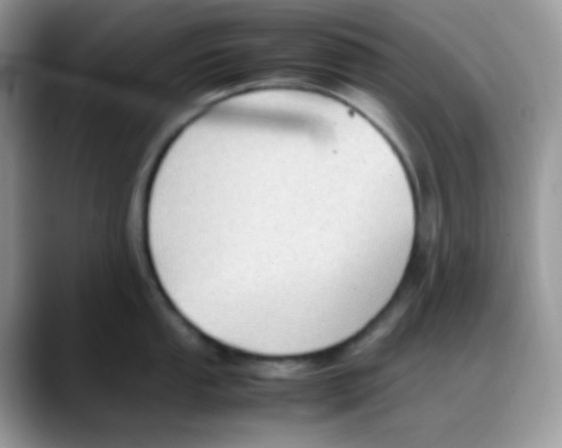 X0000088151053200706111440