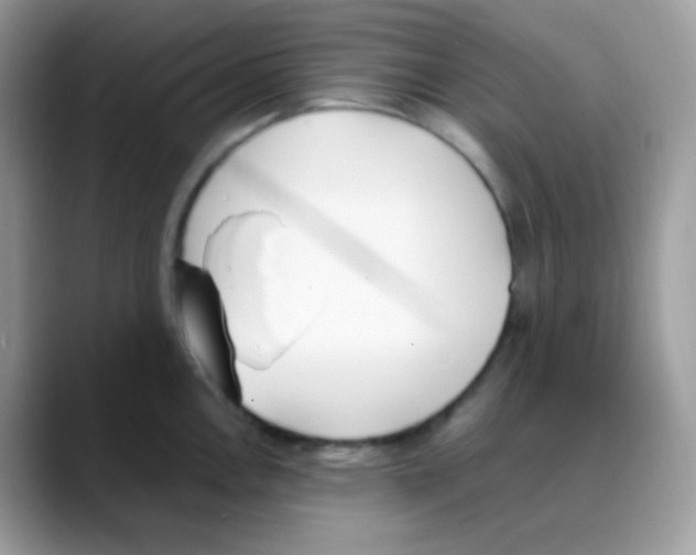 X0000088151146200706111439