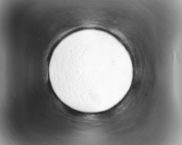 X0000088151175200706111438