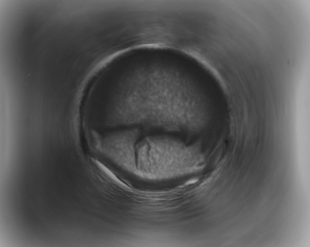 X0000088151319200706111436