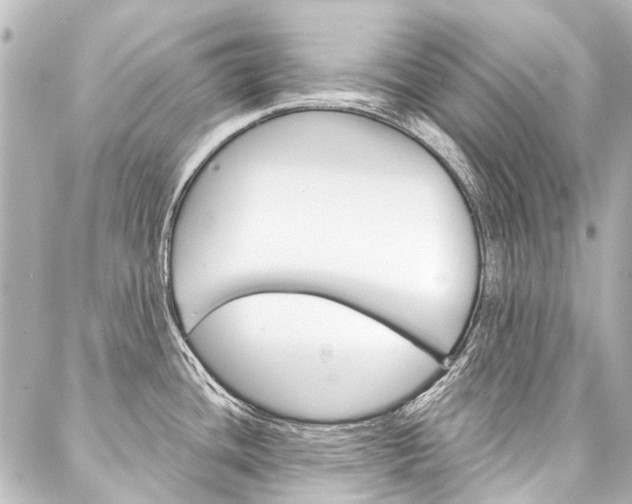 X0000088161436200705150914