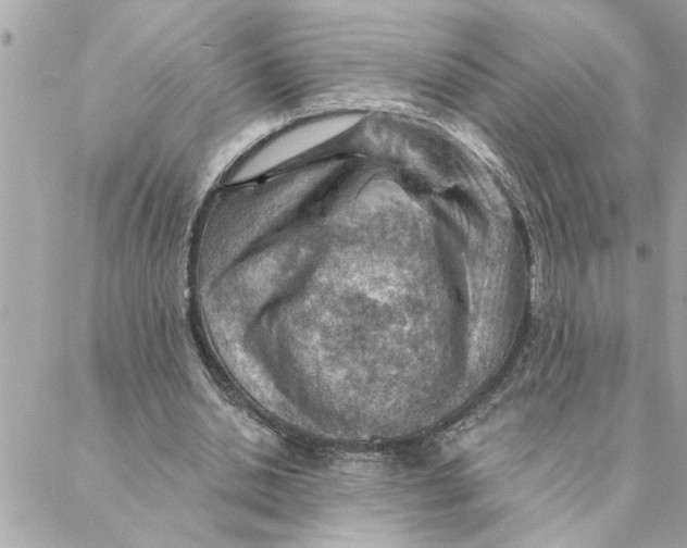 X0000088160438200706051055