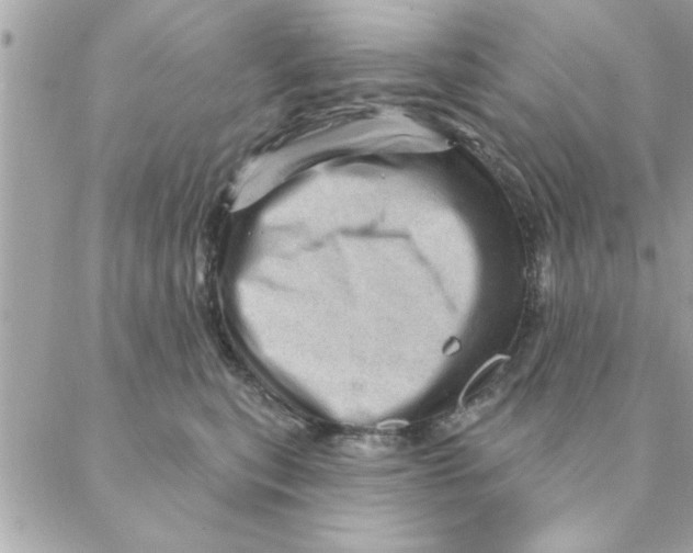 X0000088160567200706051054