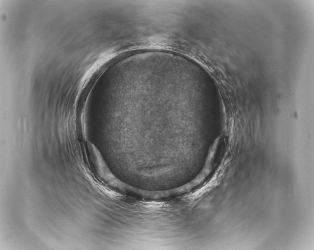 X0000088170200200705151157