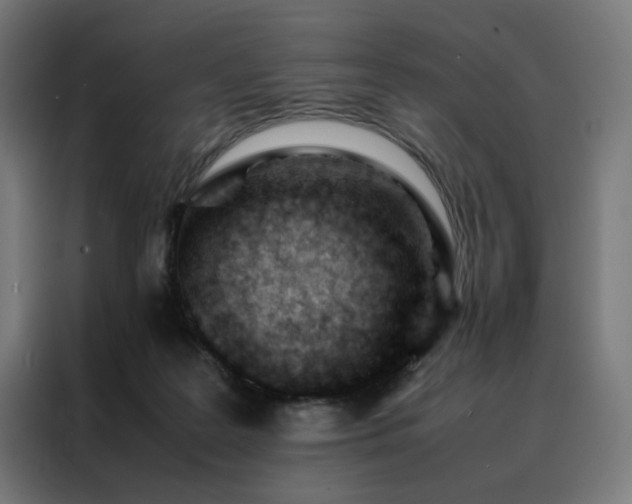 X0000088170219200705221628