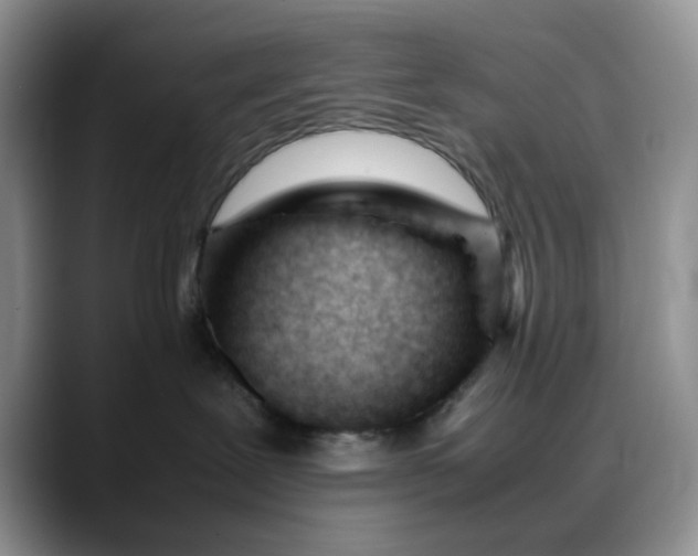 X0000088170239200705291938