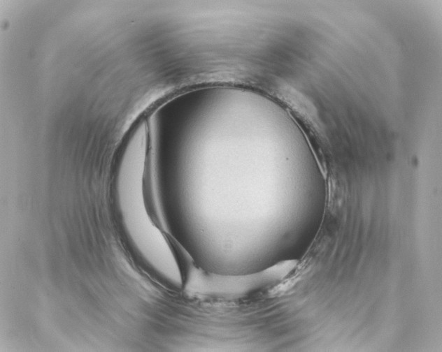 X0000088170156200706051125