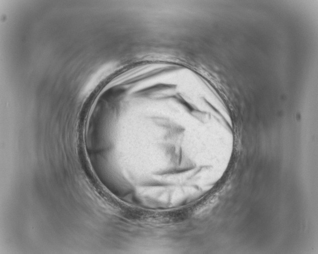 X0000088170199200706051125