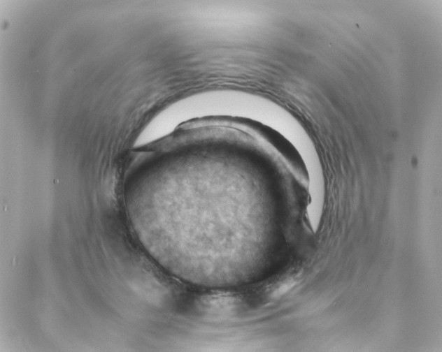 X0000088170219200706051125