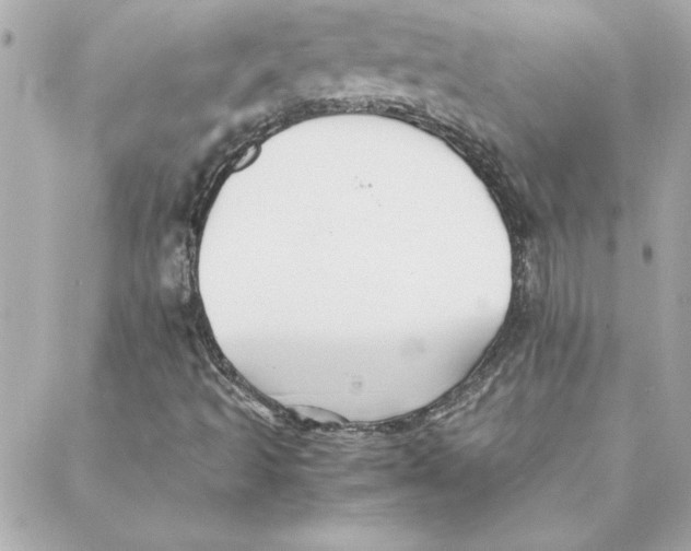 X0000088171493200706051103