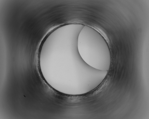 X0000088181000200705150936