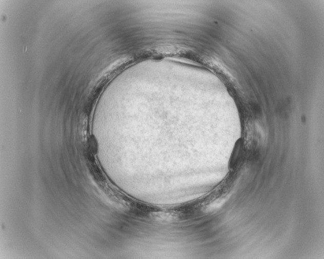 X0000088180356200706051147