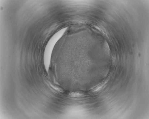 X0000088180766200706051141