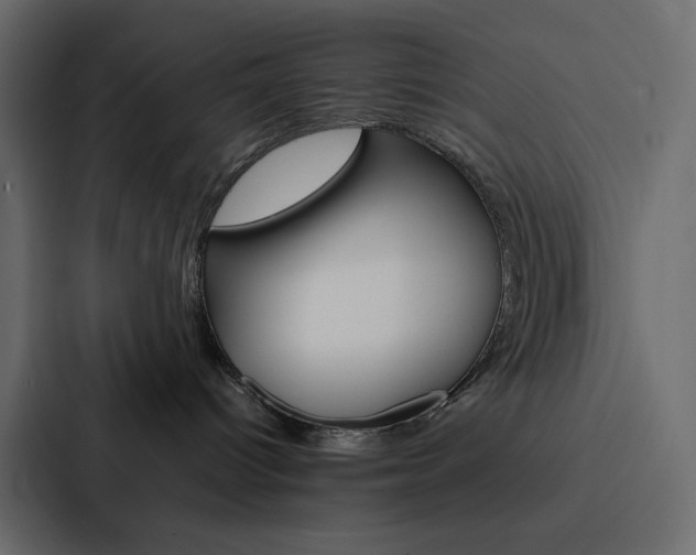 X0000088190096200705151008