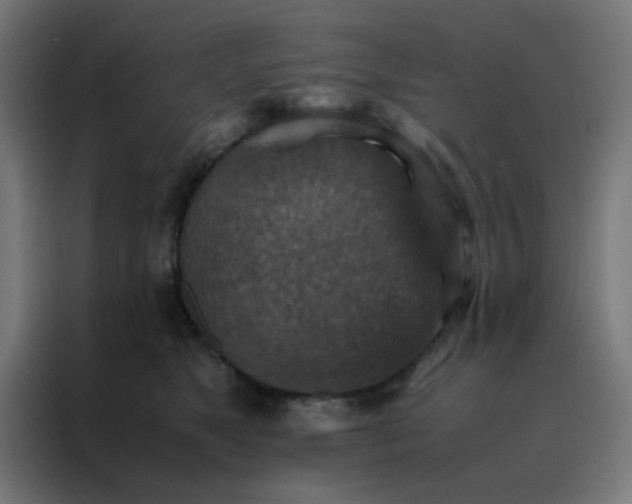 X0000088190517200705221705