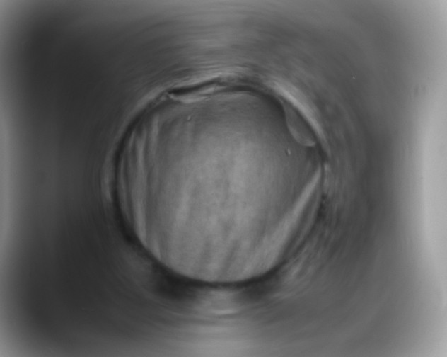 X0000088190107200705292020