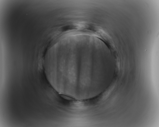 X0000088190325200705292017