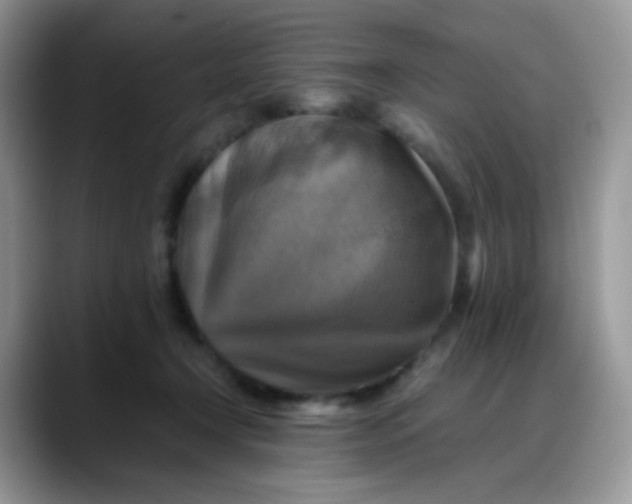 X0000088190366200705292017