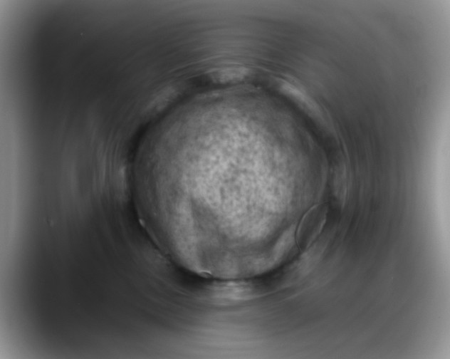 X0000088190378200705292017
