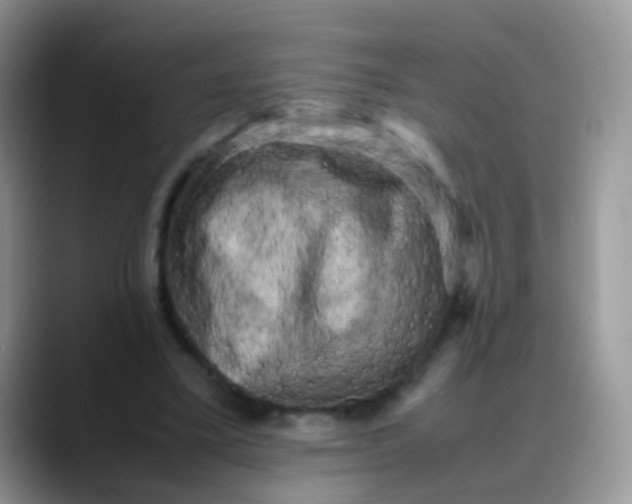 X0000088190395200705292016
