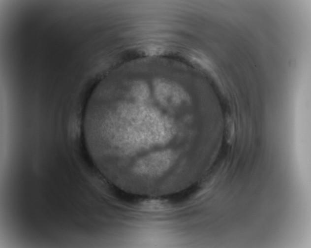 X0000088190499200705292015
