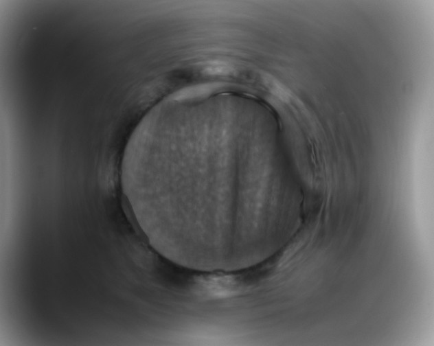X0000088190517200705292015