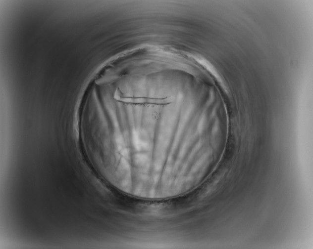 X0000088190791200705292011