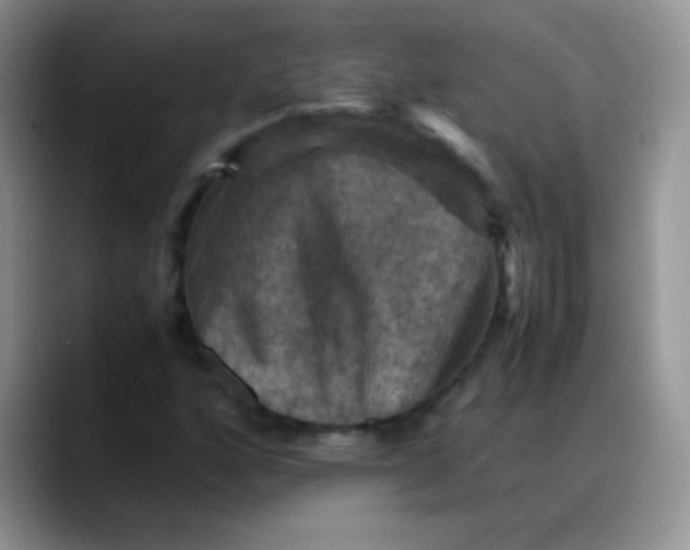 X0000088191160200705292006
