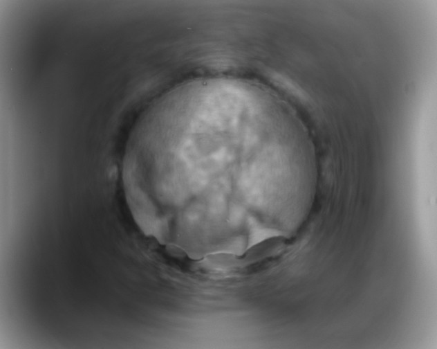 X0000088191302200705292004