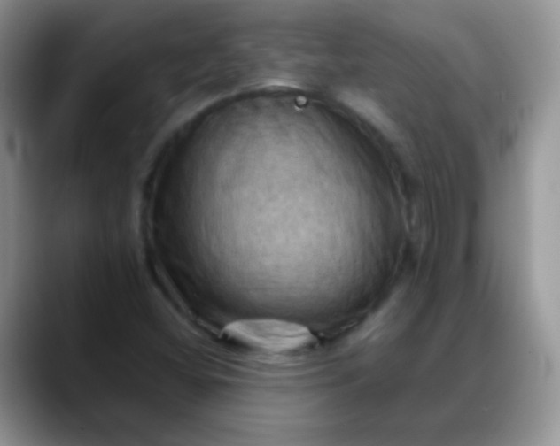 X0000088191404200705292003