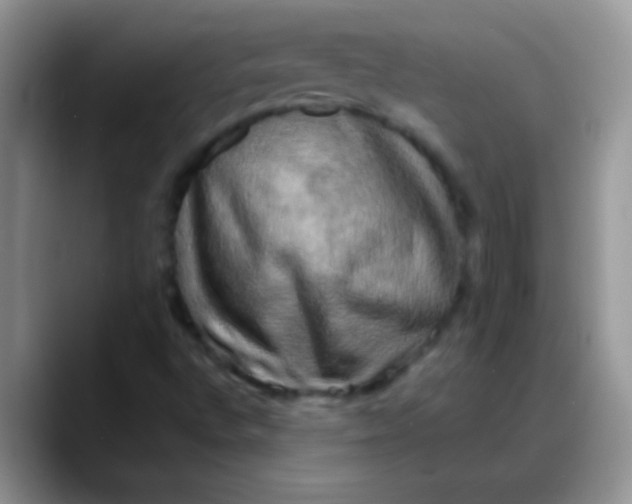 X0000088191496200705292001
