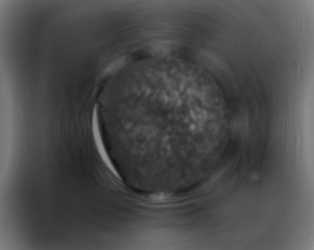 X0000088200335200705221728