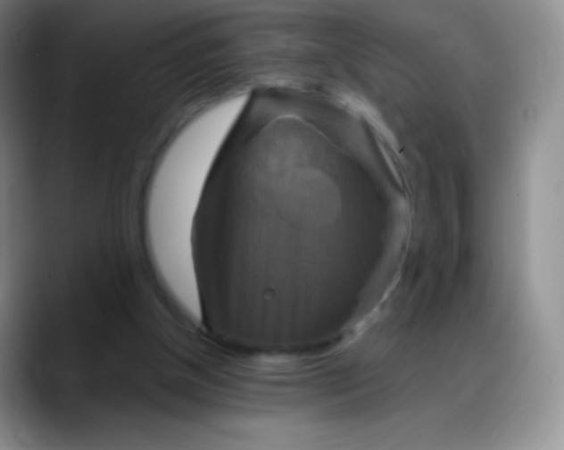 X0000088200154200705292039