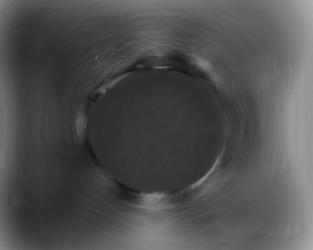 X0000088200192200705292040